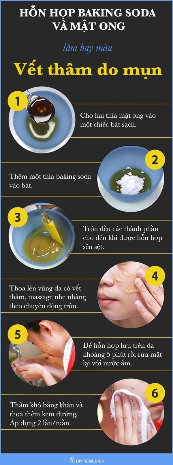 Làm bay màu vết thâm do mụn nhờ hỗn hợp mật ong và baking soda